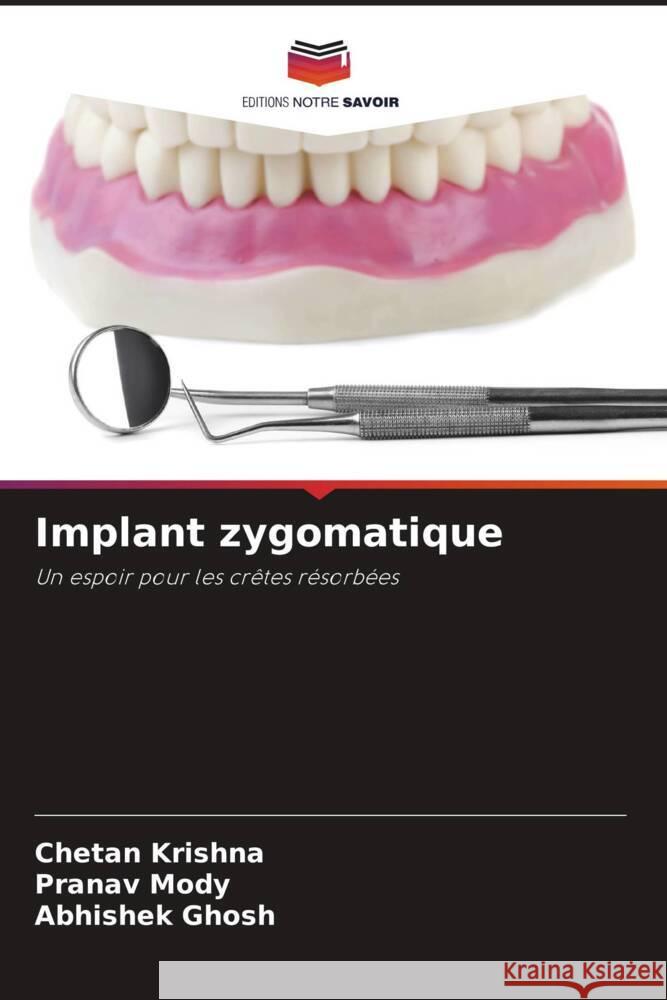 Implant zygomatique Krishna, Chetan, Mody, Pranav, Ghosh, Abhishek 9786206345688