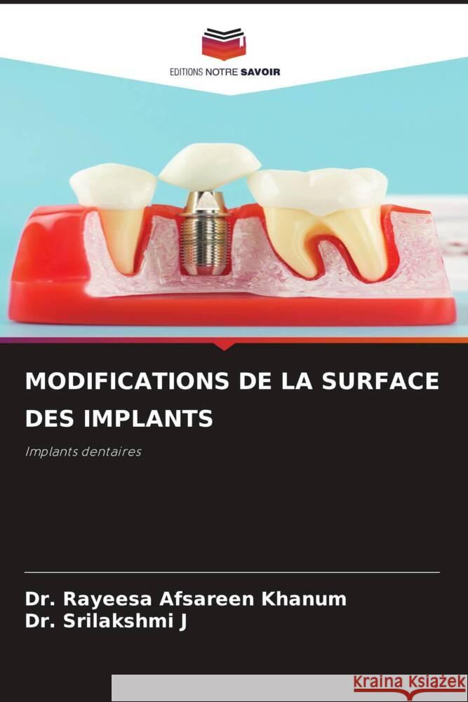 MODIFICATIONS DE LA SURFACE DES IMPLANTS Khanum, Dr. Rayeesa Afsareen, J, Dr. Srilakshmi 9786206357131