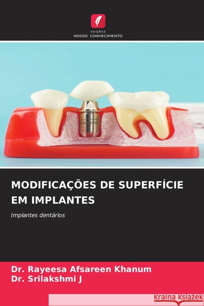 MODIFICAÇÕES DE SUPERFÍCIE EM IMPLANTES Khanum, Dr. Rayeesa Afsareen, J, Dr. Srilakshmi 9786206357155