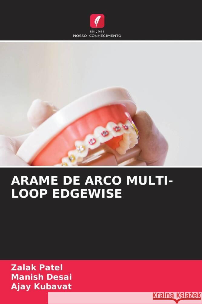 ARAME DE ARCO MULTI-LOOP EDGEWISE Patel, Zalak, Desai, Manish, KUBAVAT, AJAY 9786206358411