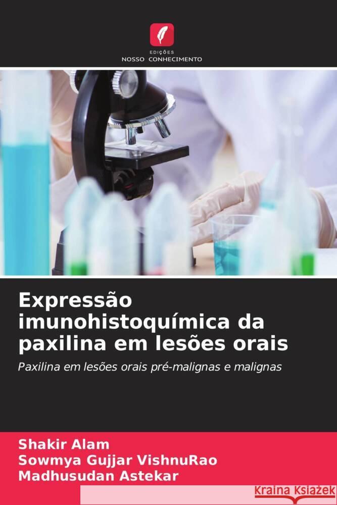 Expressão imunohistoquímica da paxilina em lesões orais Alam, Shakir, Gujjar VishnuRao, Sowmya, Astekar, Madhusudan 9786206367208