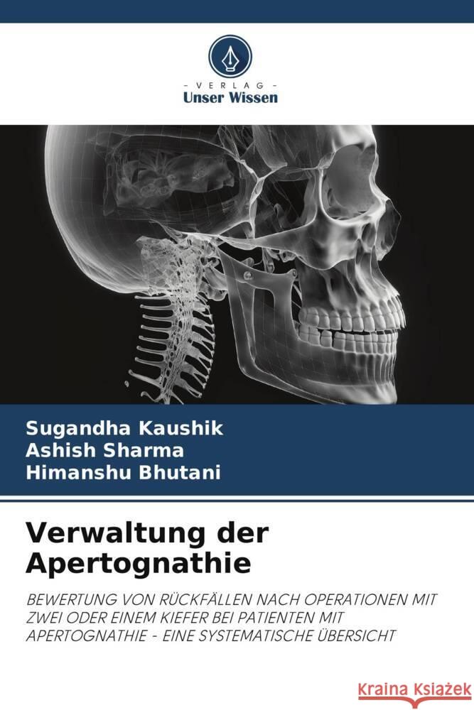 Verwaltung der Apertognathie Kaushik, Sugandha, Sharma, Ashish, Bhutani, Himanshu 9786206368694