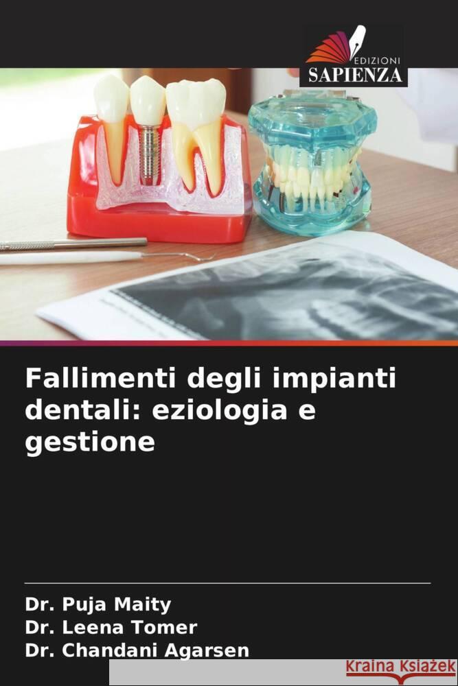 Fallimenti degli impianti dentali: eziologia e gestione Maity, Dr. Puja, Tomer, Dr. Leena, Agarsen, Dr. Chandani 9786206369226