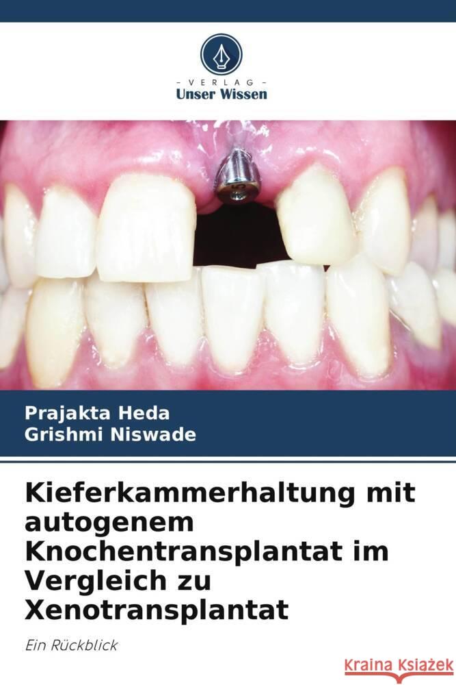 Kieferkammerhaltung mit autogenem Knochentransplantat im Vergleich zu Xenotransplantat Heda, Prajakta, Niswade, Grishmi 9786206380948 Verlag Unser Wissen