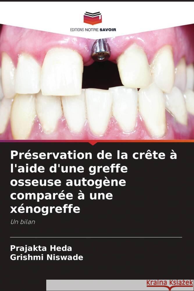 Préservation de la crête à l'aide d'une greffe osseuse autogène comparée à une xénogreffe Heda, Prajakta, Niswade, Grishmi 9786206380962