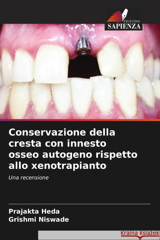 Conservazione della cresta con innesto osseo autogeno rispetto allo xenotrapianto Heda, Prajakta, Niswade, Grishmi 9786206380979