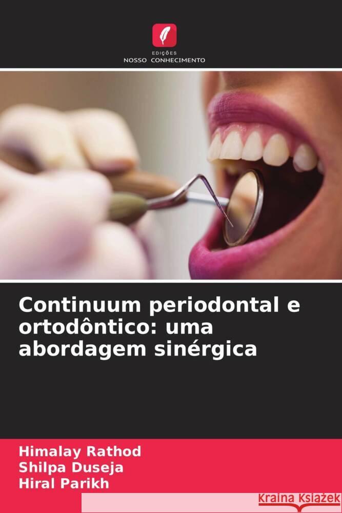 Continuum periodontal e ortod?ntico: uma abordagem sin?rgica Himalay Rathod Shilpa Duseja Hiral Parikh 9786206383710 Edicoes Nosso Conhecimento