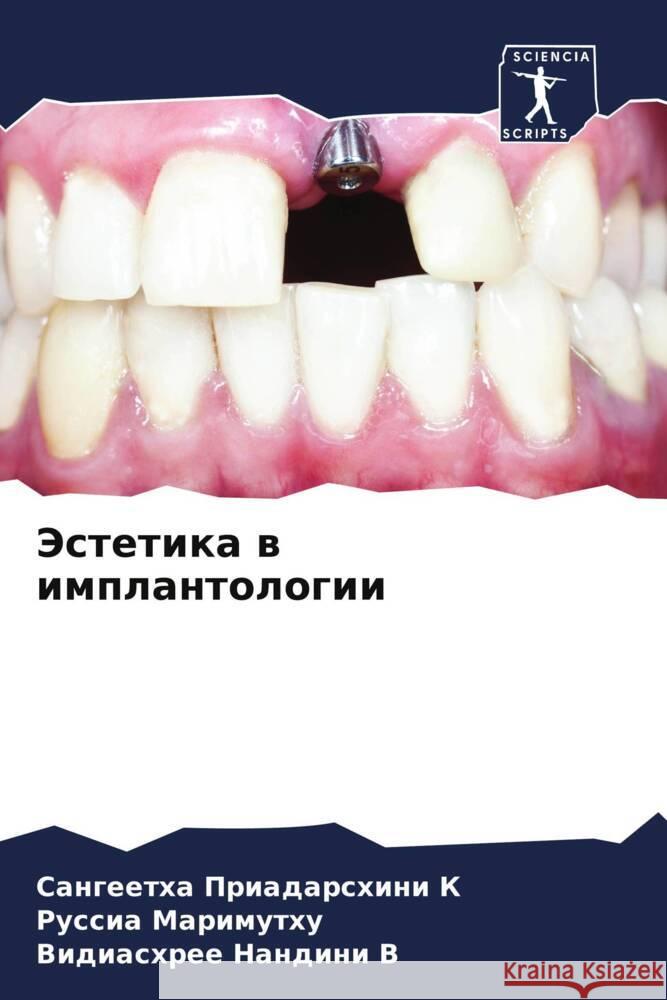 Jestetika w implantologii K, Sangeetha Priadarshini, Marimuthu, Russia, V, Vidiashree Nandini 9786206393443 Sciencia Scripts