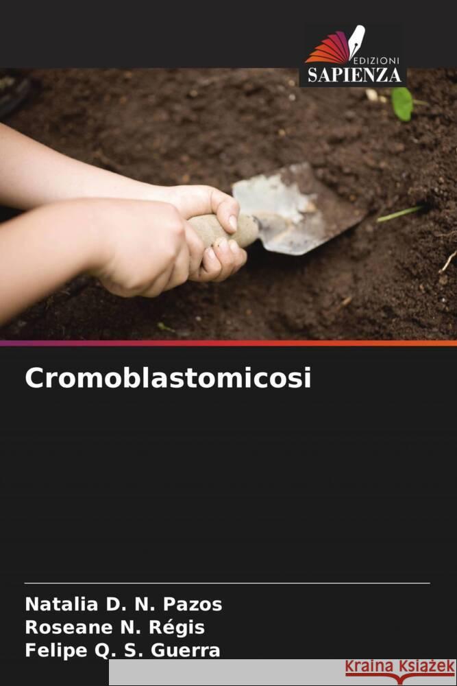 Cromoblastomicosi D. N. Pazos, Natalia, N. Régis, Roseane, Q. S. Guerra, Felipe 9786206395416