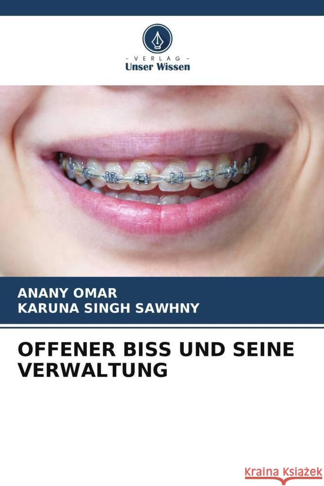 OFFENER BISS UND SEINE VERWALTUNG Omar, Anany, Sawhny, Karuna Singh 9786206399360