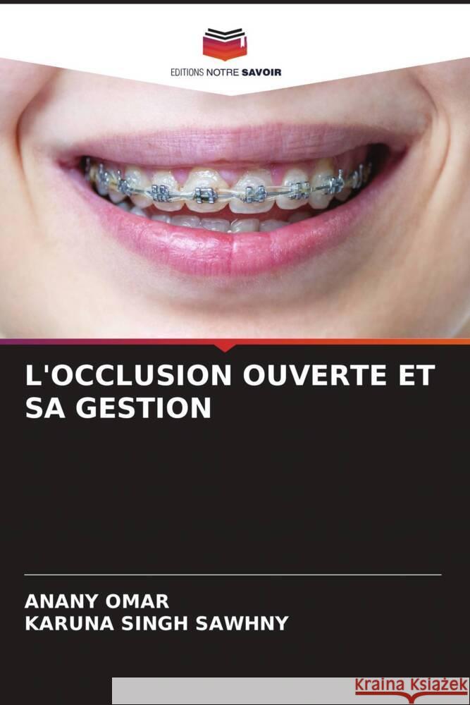 L'OCCLUSION OUVERTE ET SA GESTION Omar, Anany, Sawhny, Karuna Singh 9786206399384