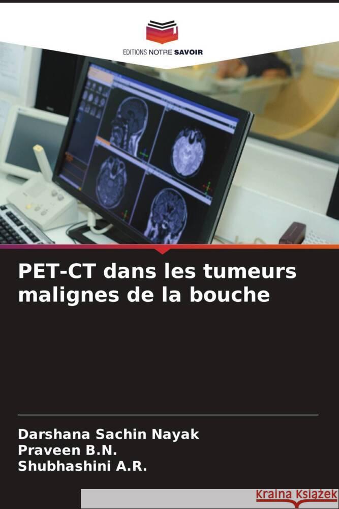 PET-CT dans les tumeurs malignes de la bouche Nayak, Darshana Sachin, B.N., Praveen, A.R., Shubhashini 9786206402749