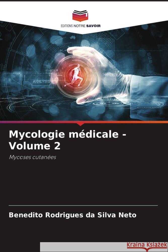 Mycologie médicale - Volume 2 Rodrigues da Silva Neto, Benedito 9786206404637 Editions Notre Savoir