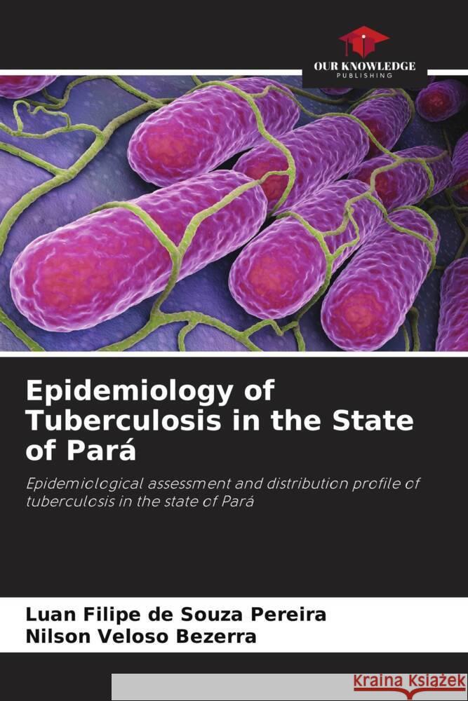 Epidemiology of Tuberculosis in the State of Pará de Souza Pereira, Luan Filipe, Bezerra, Nilson Veloso 9786206405139