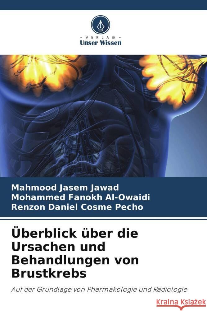 Überblick über die Ursachen und Behandlungen von Brustkrebs Jawad, Mahmood Jasem, Al-Owaidi, Mohammed Fanokh, Pecho, Renzon Daniel Cosme 9786206405184
