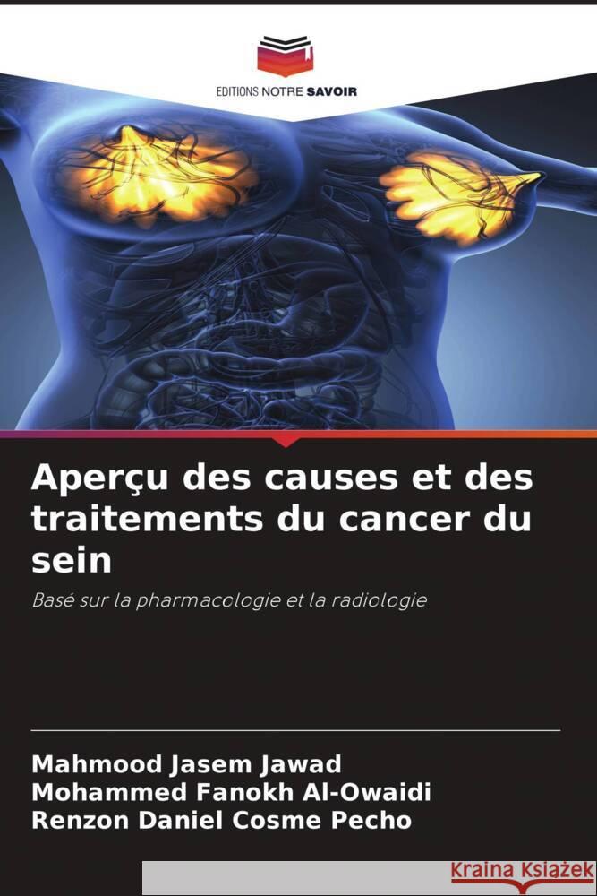 Aperçu des causes et des traitements du cancer du sein Jawad, Mahmood Jasem, Al-Owaidi, Mohammed Fanokh, Pecho, Renzon Daniel Cosme 9786206405191