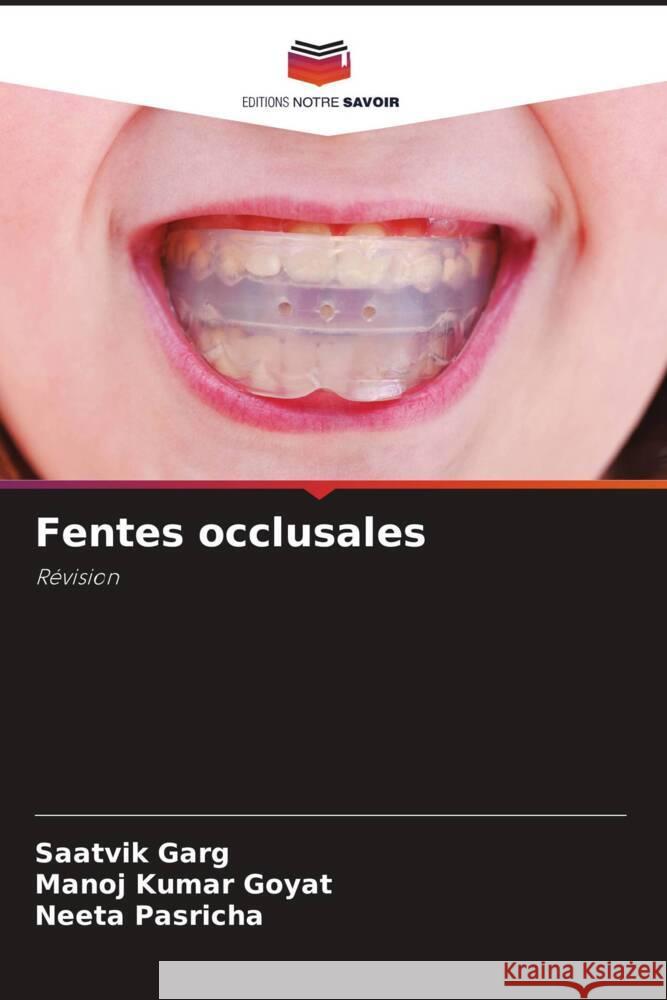 Fentes occlusales Garg, Saatvik, Goyat, Manoj Kumar, Pasricha, Neeta 9786206411994 Editions Notre Savoir