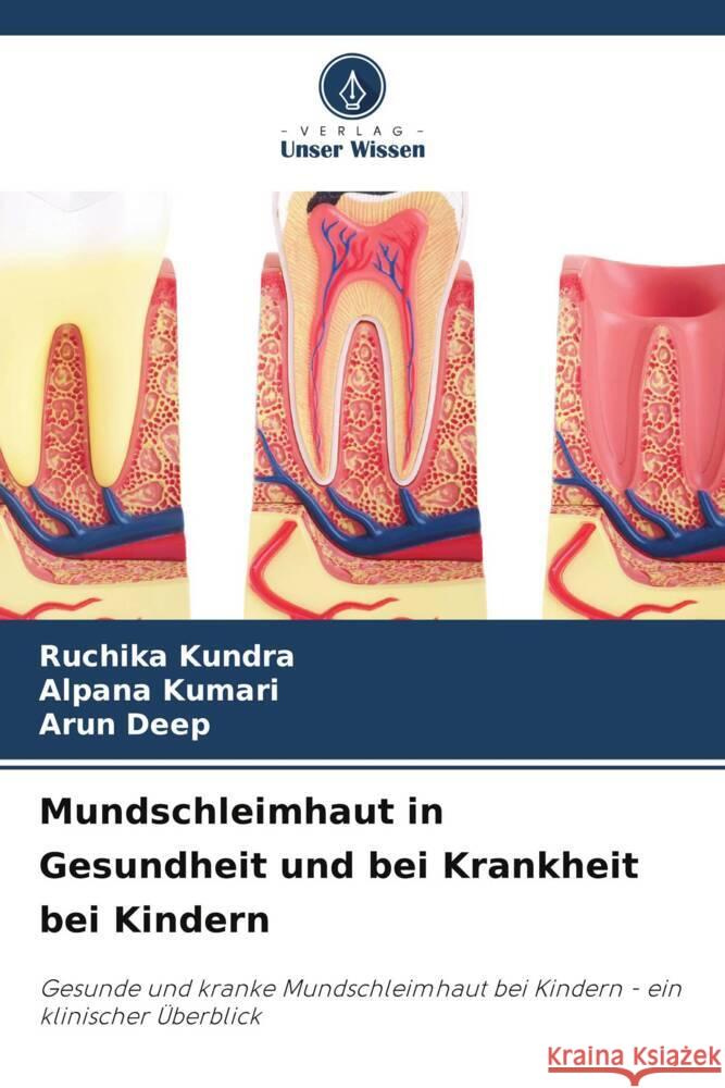 Mundschleimhaut in Gesundheit und bei Krankheit bei Kindern Kundra, Ruchika, Kumari, Alpana, Deep, Arun 9786206414810