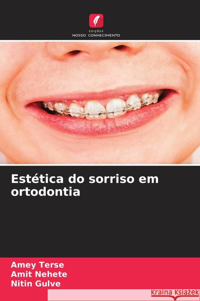 Estética do sorriso em ortodontia TERSE, AMEY, Nehete, Amit, Gulve, Nitin 9786206428770 Edições Nosso Conhecimento