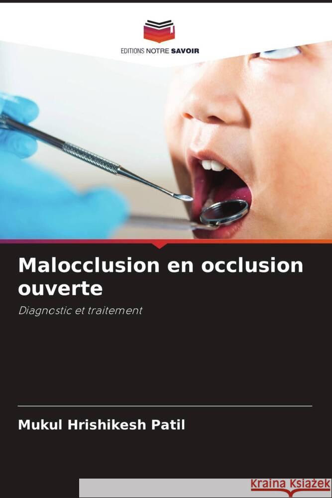 Malocclusion en occlusion ouverte Patil, Mukul Hrishikesh 9786206432906