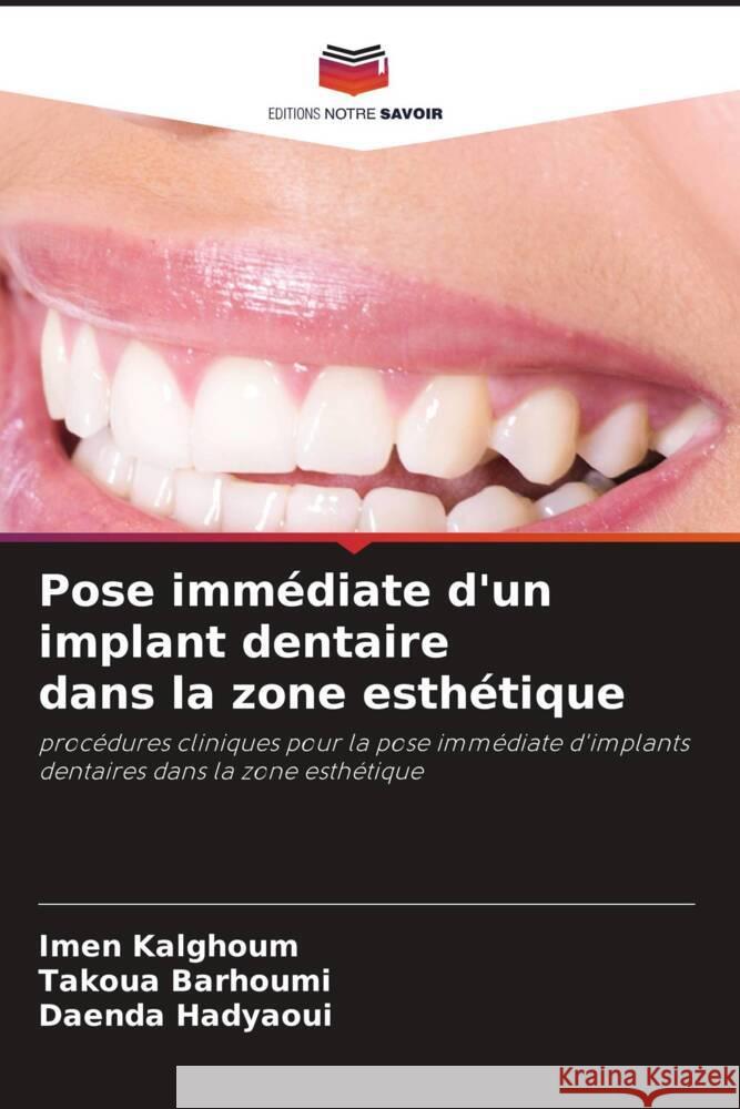 Pose immédiate d'un implant dentaire dans la zone esthétique Kalghoum, Imen, Barhoumi, Takoua, Hadyaoui, Daenda 9786206435068 Editions Notre Savoir