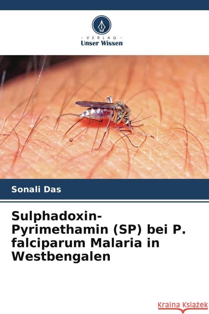 Sulphadoxin-Pyrimethamin (SP) bei P. falciparum Malaria in Westbengalen Das, Sonali 9786206438069