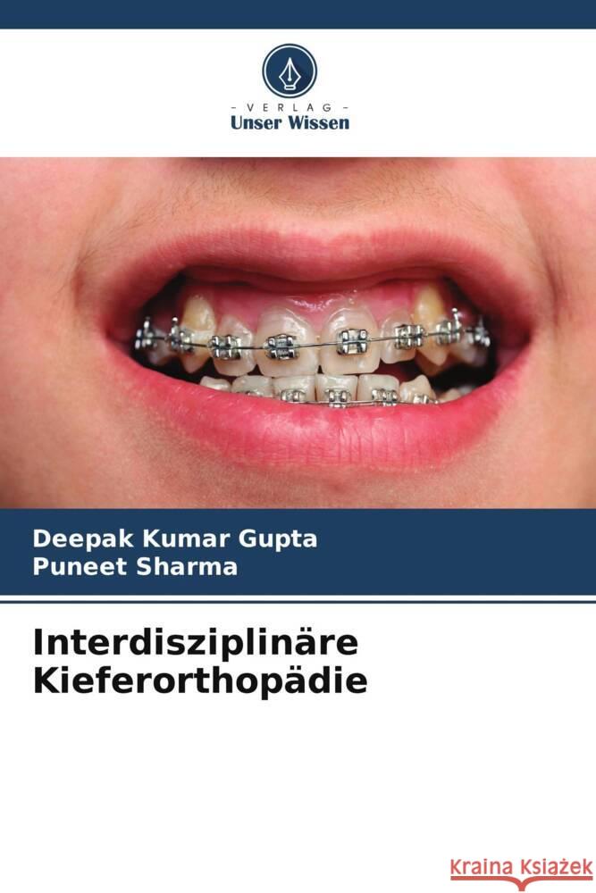 Interdisziplinäre Kieferorthopädie Kumar Gupta, Deepak, Sharma, Puneet 9786206438120 Verlag Unser Wissen