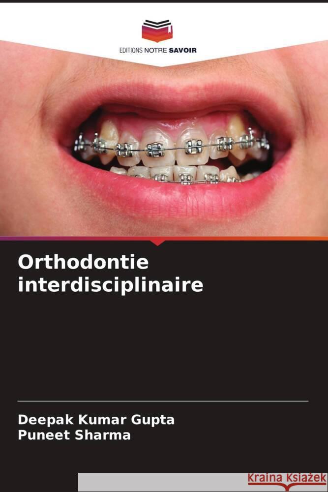 Orthodontie interdisciplinaire Kumar Gupta, Deepak, Sharma, Puneet 9786206438144 Editions Notre Savoir