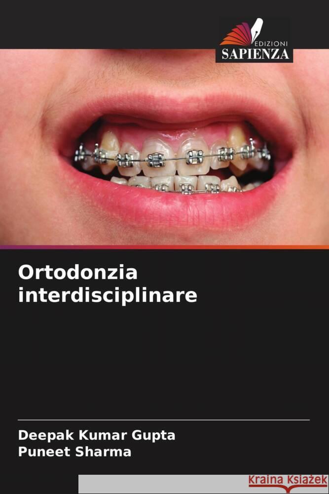 Ortodonzia interdisciplinare Kumar Gupta, Deepak, Sharma, Puneet 9786206438151 Edizioni Sapienza