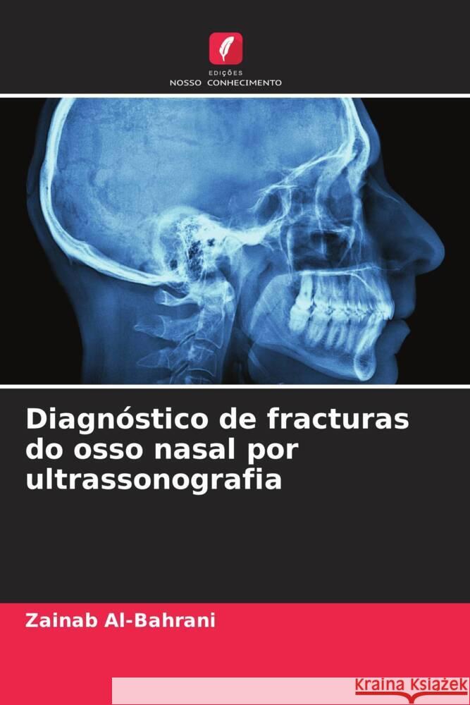 Diagnóstico de fracturas do osso nasal por ultrassonografia Al-Bahrani, Zainab 9786206449379