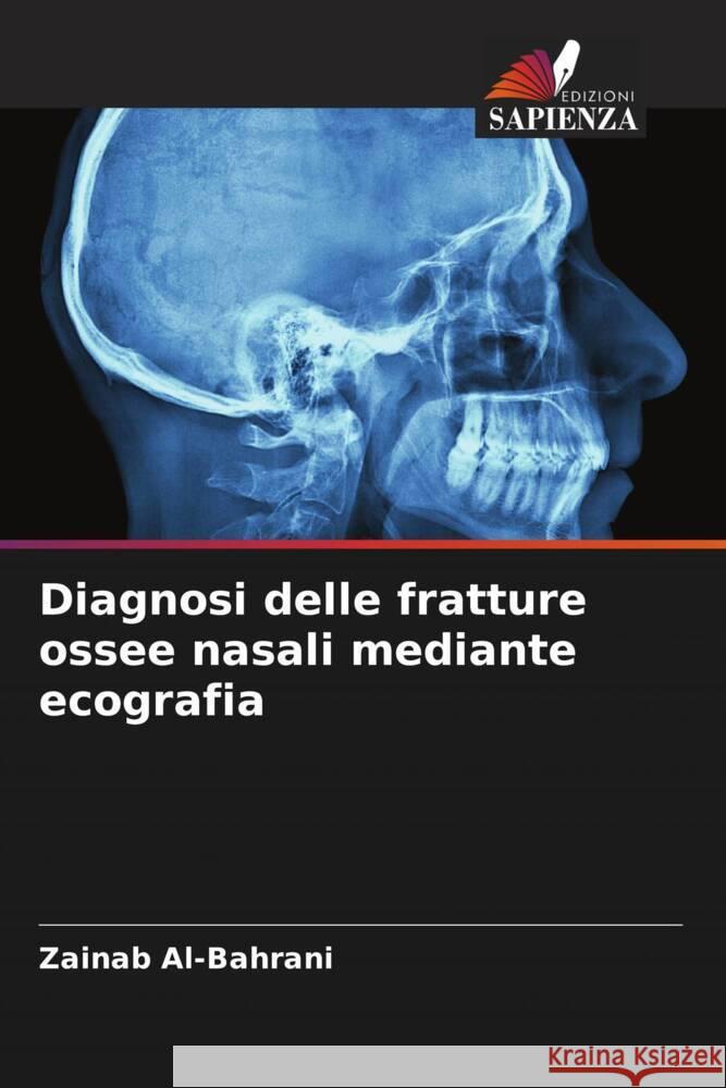 Diagnosi delle fratture ossee nasali mediante ecografia Al-Bahrani, Zainab 9786206449386