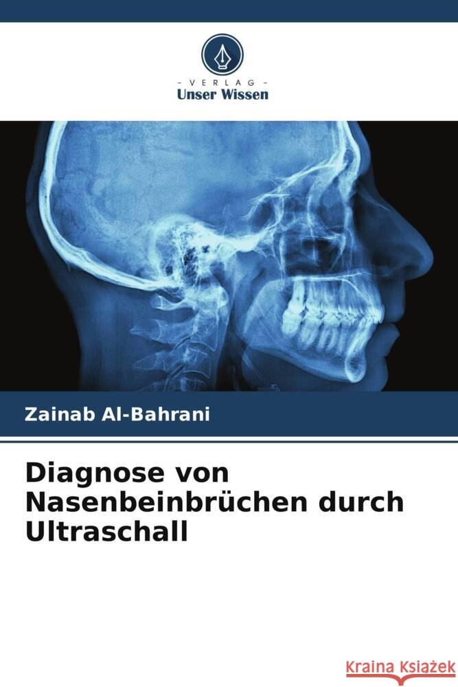 Diagnose von Nasenbeinbrüchen durch Ultraschall Al-Bahrani, Zainab 9786206449423