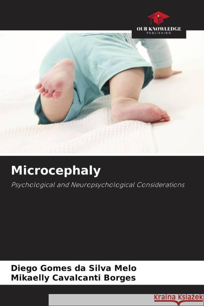 Microcephaly Gomes da Silva Melo, Diego, Borges, Mikaelly Cavalcanti 9786206460800