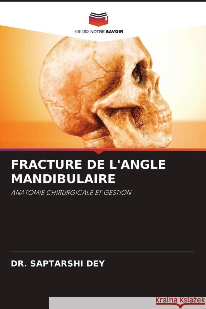 FRACTURE DE L'ANGLE MANDIBULAIRE DEY, DR. SAPTARSHI 9786206463306