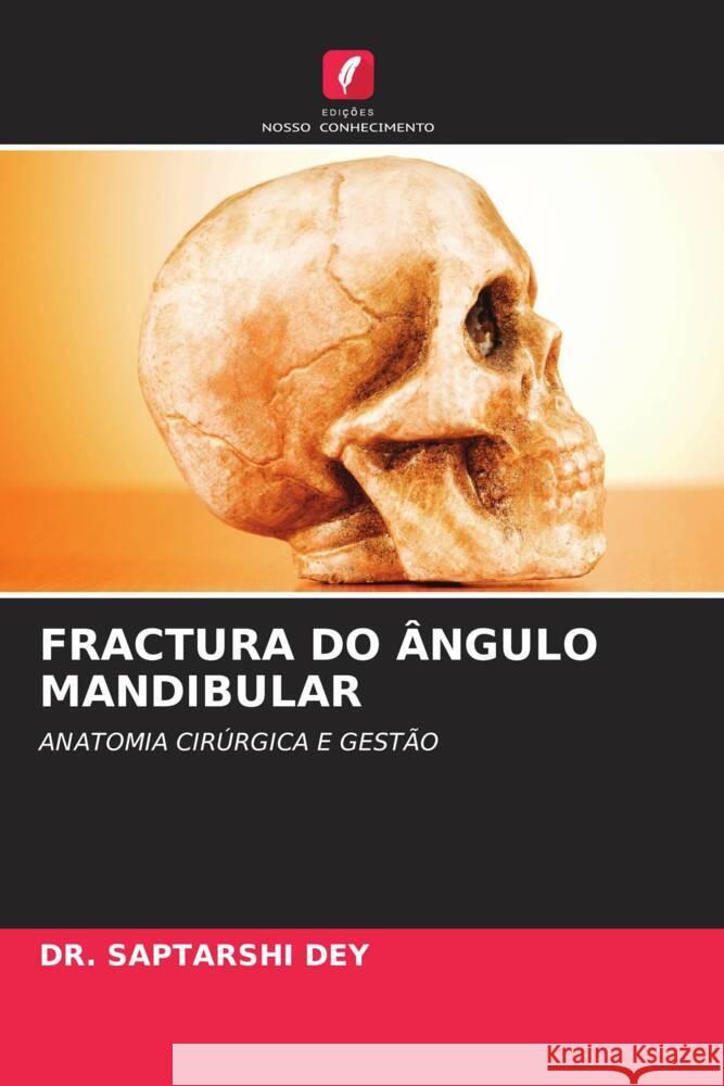 FRACTURA DO ÂNGULO MANDIBULAR DEY, DR. SAPTARSHI 9786206463320