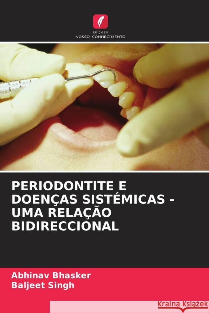 PERIODONTITE E DOENÇAS SISTÉMICAS - UMA RELAÇÃO BIDIRECCIONAL Bhasker, Abhinav, Singh, Baljeet 9786206477129