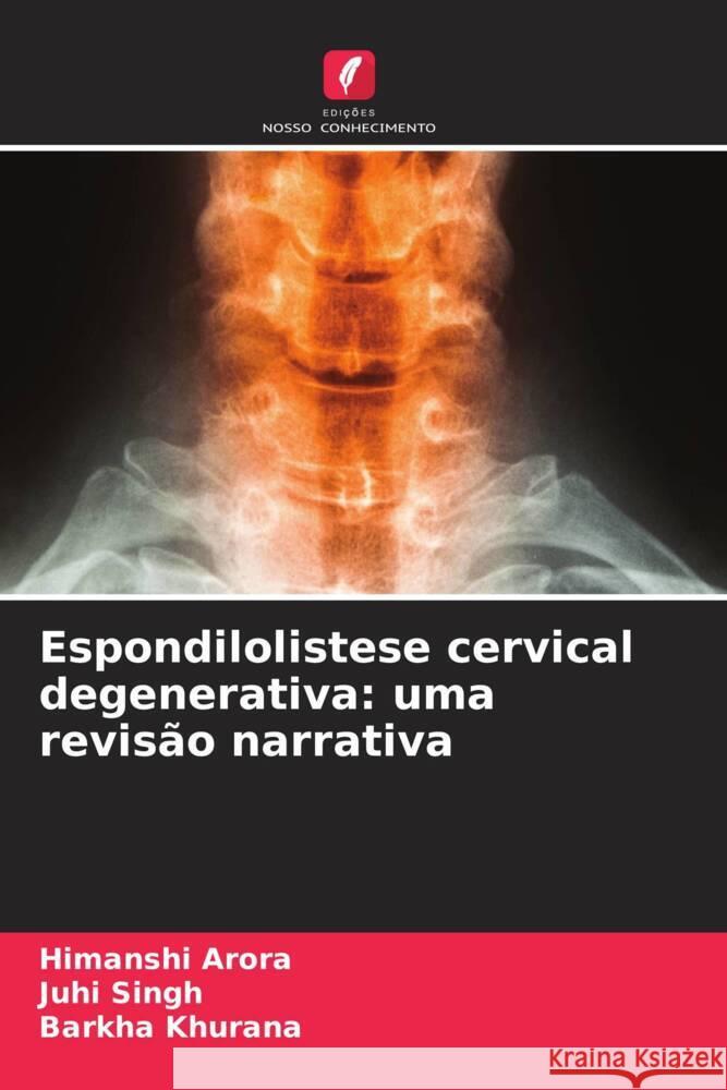 Espondilolistese cervical degenerativa: uma revisão narrativa Arora, Himanshi, Singh, Juhi, Khurana, Barkha 9786206479789