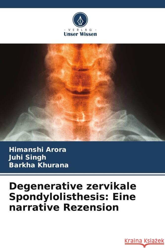 Degenerative zervikale Spondylolisthesis: Eine narrative Rezension Himanshi Arora Juhi Singh Barkha Khurana 9786206479796