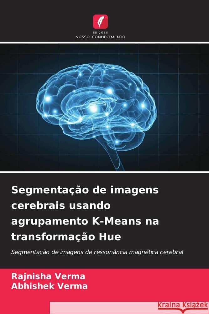 Segmentação de imagens cerebrais usando agrupamento K-Means na transformação Hue Verma, Rajnisha, Verma, Abhishek 9786206482031