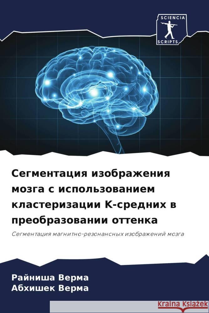 Segmentaciq izobrazheniq mozga s ispol'zowaniem klasterizacii K-srednih w preobrazowanii ottenka Verma, Rajnisha, Verma, Abhishek 9786206482062