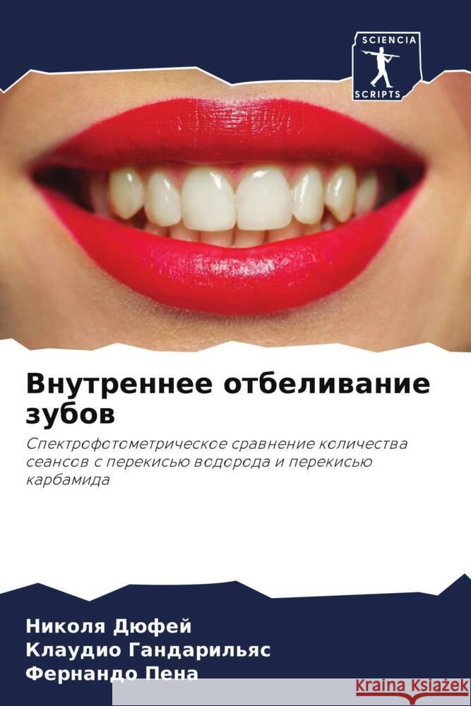 Vnutrennee otbeliwanie zubow Düfej, Nikolq, Gandaril'qs, Klaudio, Pena, Fernando 9786206483922 Sciencia Scripts