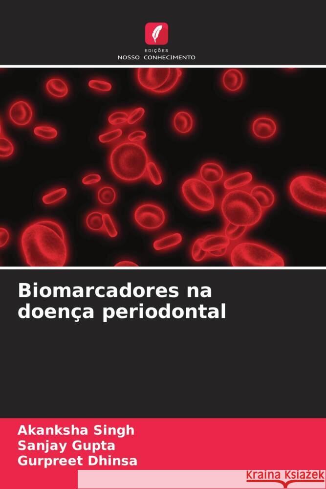 Biomarcadores na doença periodontal Singh, Akanksha, Gupta, Sanjay, Dhinsa, Gurpreet 9786206488637 Edições Nosso Conhecimento