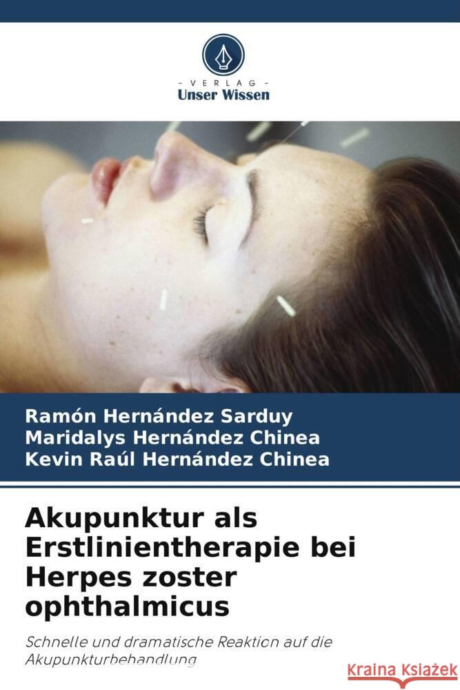 Akupunktur als Erstlinientherapie bei Herpes zoster ophthalmicus Hernández Sarduy, Ramón, Hernández Chinea, Maridalys, Hernández Chinea, Kevin Raúl 9786206491170 Verlag Unser Wissen