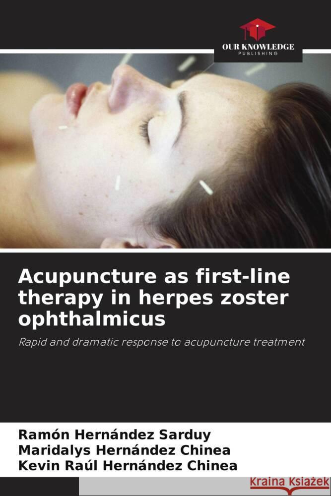 Acupuncture as first-line therapy in herpes zoster ophthalmicus Hernández Sarduy, Ramón, Hernández Chinea, Maridalys, Hernández Chinea, Kevin Raúl 9786206491187 Our Knowledge Publishing