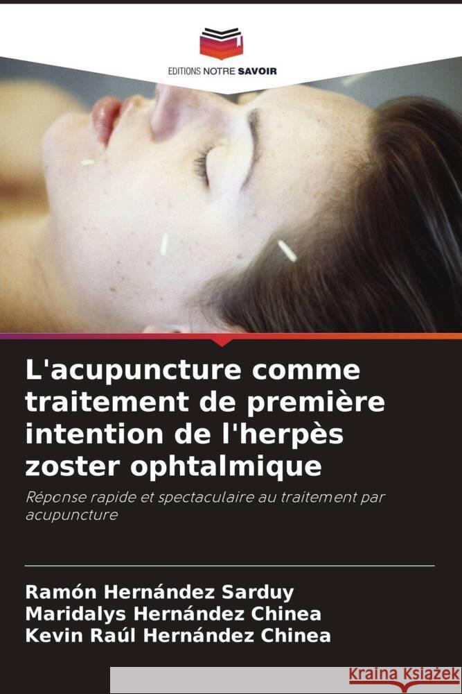 L'acupuncture comme traitement de première intention de l'herpès zoster ophtalmique Hernández Sarduy, Ramón, Hernández Chinea, Maridalys, Hernández Chinea, Kevin Raúl 9786206491194 Editions Notre Savoir
