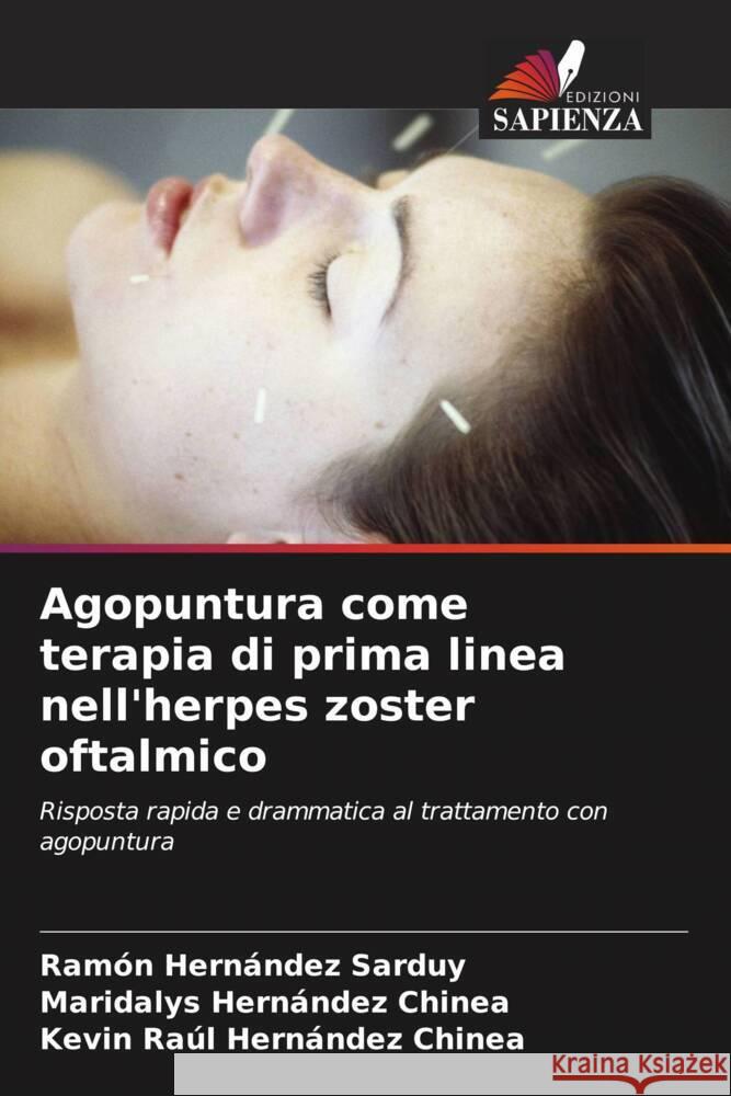 Agopuntura come terapia di prima linea nell'herpes zoster oftalmico Hernández Sarduy, Ramón, Hernández Chinea, Maridalys, Hernández Chinea, Kevin Raúl 9786206491231 Edizioni Sapienza