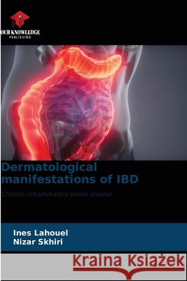 Dermatological manifestations of IBD Lahouel, Ines, Skhiri, Nizar 9786206494836 Our Knowledge Publishing