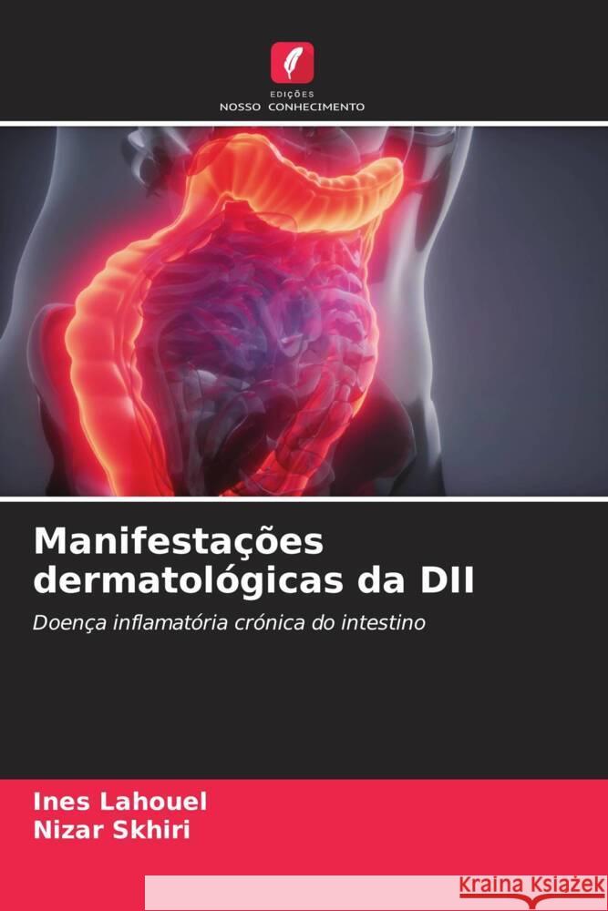 Manifestações dermatológicas da DII Lahouel, Ines, Skhiri, Nizar 9786206494867 Edições Nosso Conhecimento