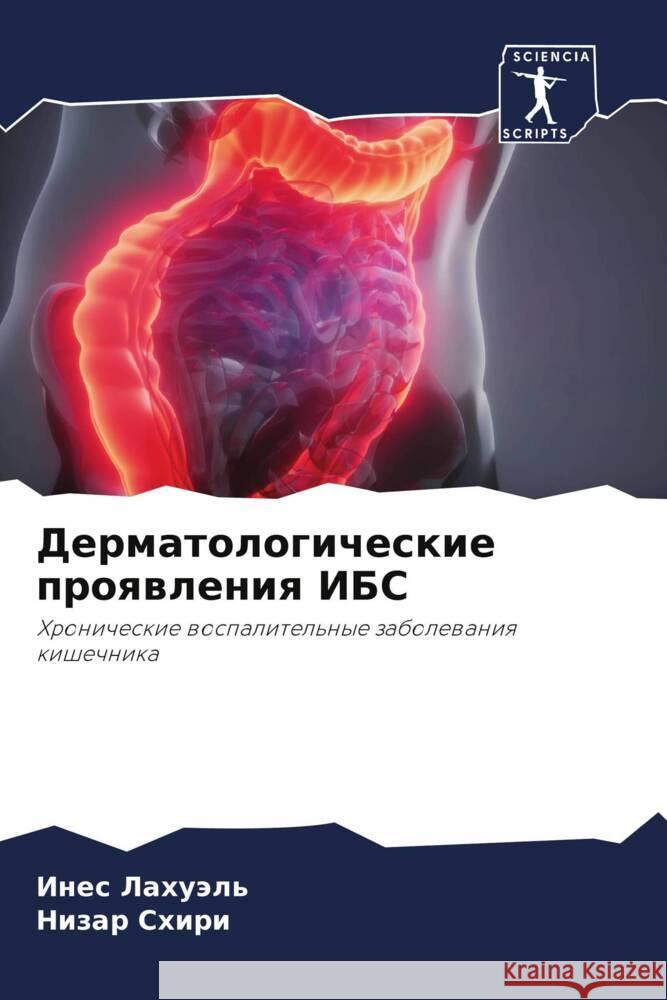 Dermatologicheskie proqwleniq IBS Lahuäl', Ines, Shiri, Nizar 9786206494874 Sciencia Scripts