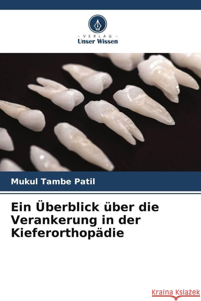 Ein Überblick über die Verankerung in der Kieferorthopädie Tambe Patil, Mukul 9786206497400